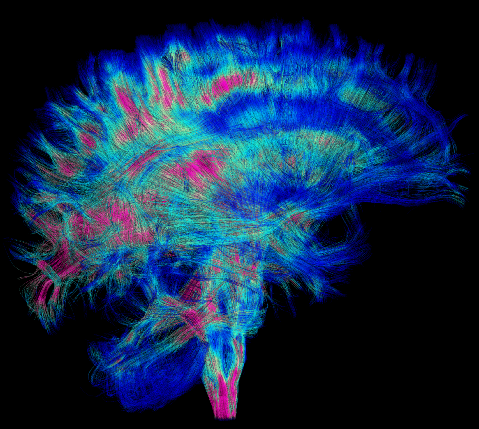 Brain scan